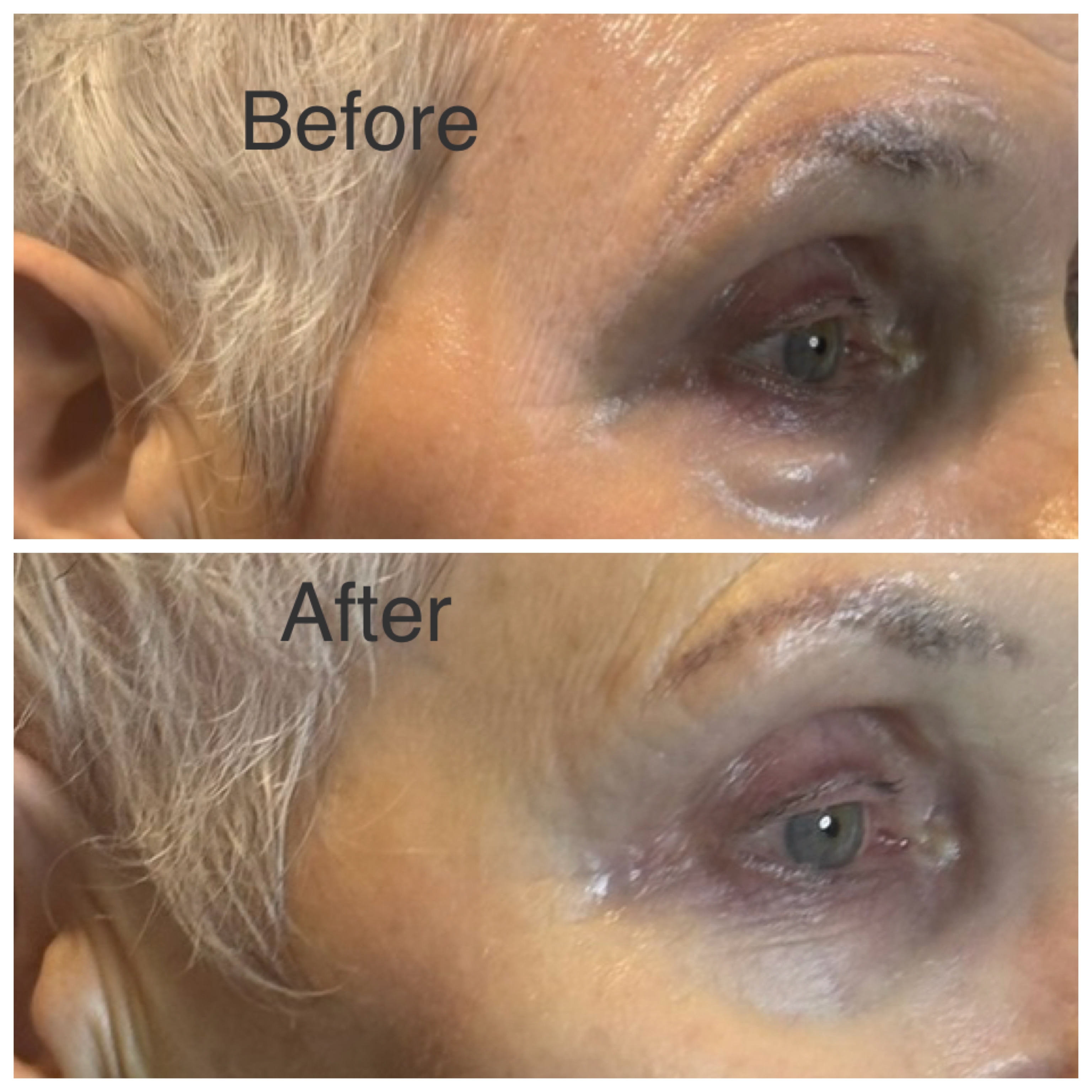 Microblading — Brow Definition